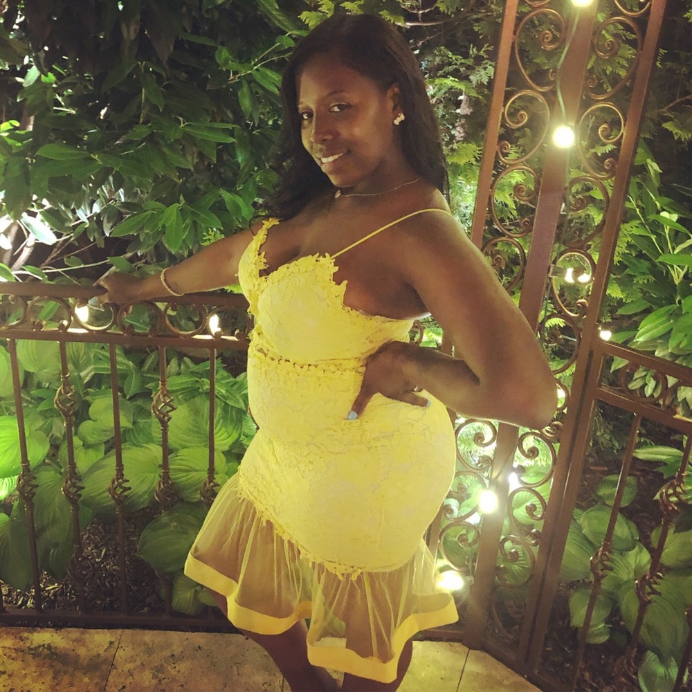 Sexy Sunshine Lace Dress